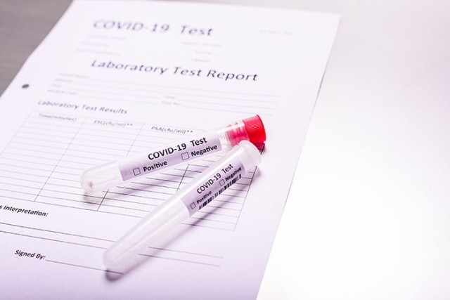 COVID-19 Lab Test